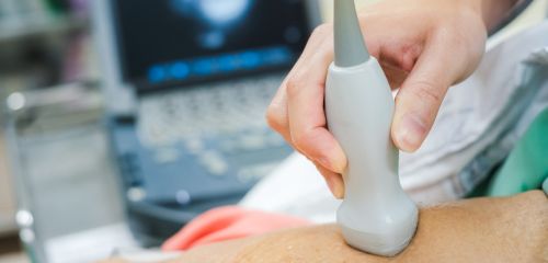 Patient receiving an echocardiogram